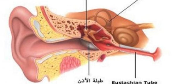 أين توجد قناة أستاكيوس