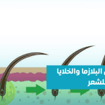 البلازما-والخلايا-الجذعية-للشعر