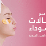 ظهور-الهالات-السوداء-ونصائح-للوقاية