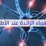 الكهرباء-الزائدة-عند-الأطفال